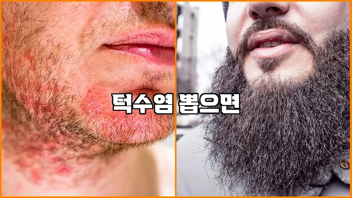 턱수염 뽑으면